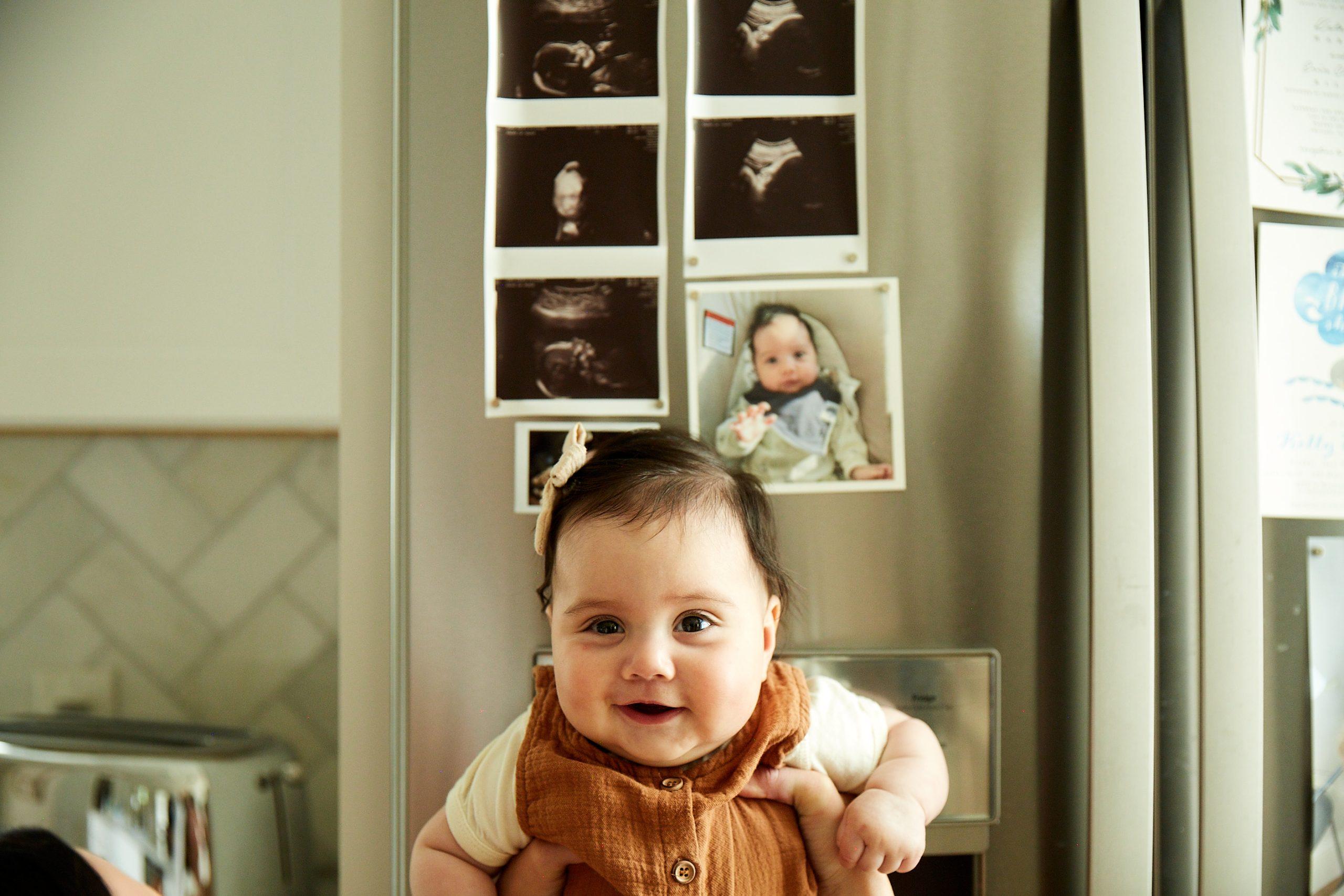 The Fertility Benefits of Omega3 Fatty Acids