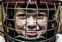 As the Orthodontist: Is it Really Worth it to get Braces?