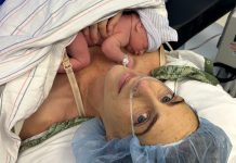 3 Things I Didn’t Expect When I Had a C-Section